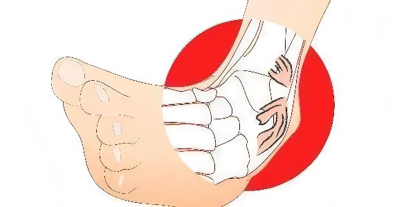 踝關(guān)節扭傷后的最佳應對指南：簡(jiǎn)單四步，助力快速康復！