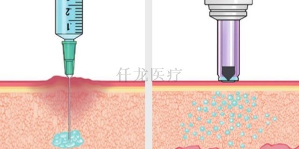無(wú)針注射器應用在哪方面